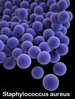 La osteomielitis es causada por una bacteria llamada Staphylococcus aureus
