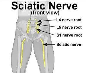 sciatic nerbiyos roots