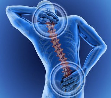 Beziehung zwischen Fibromyalgie und Rückenschmerzen