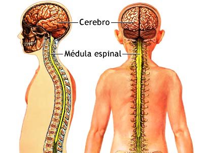 Fractura médula espinal