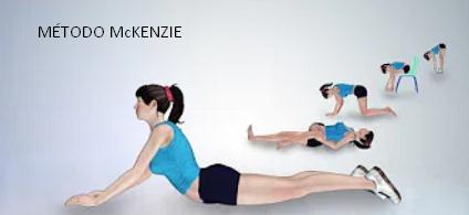 El Método McKenzie es un sistema muy utilizado como fisioterapia en columna vertebral