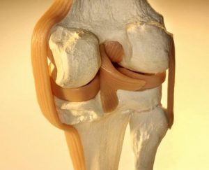 Osteofiti mogu nastati u bilo kojoj kosti