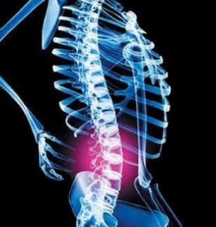 osteomielitis espinal, espondilodiscitis o infección del espacio discal