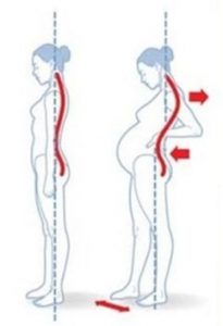 La causa de los dolores de espalda durante el embarazo se deben al cambio del centro de gravedad del cuerpo