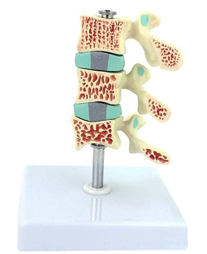 modelos anatómicos de 3 vértebras