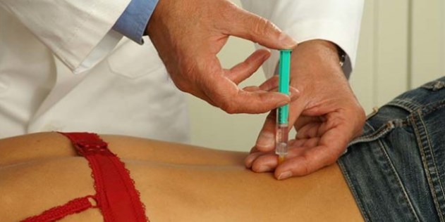 Inyección epidural para dolor de espalda